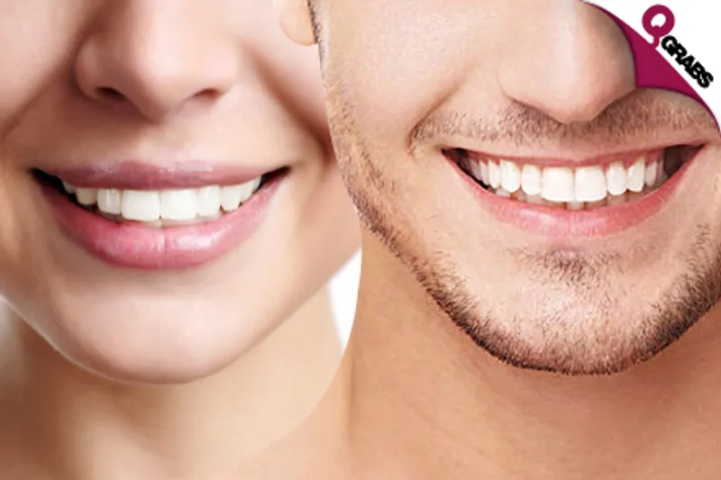 From QR900 Get a Million Dollar Smile with Philips ZOOM Technology Teeth Whitening OR Teeth Veneer! (Up to QR2700)